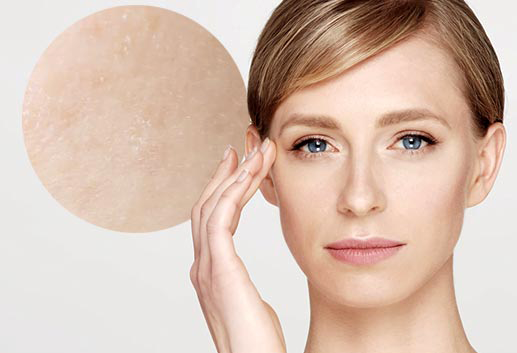 Hyaluron-Technologie Saneo2