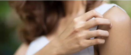 Finally no dry skin anymore!