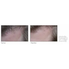 Hilft bei Schuppen und Juckreiz